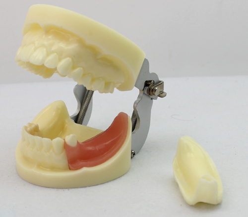 ENOVO正品 种植牙颌模型 口腔外科学教学实习模型 种植练习模型