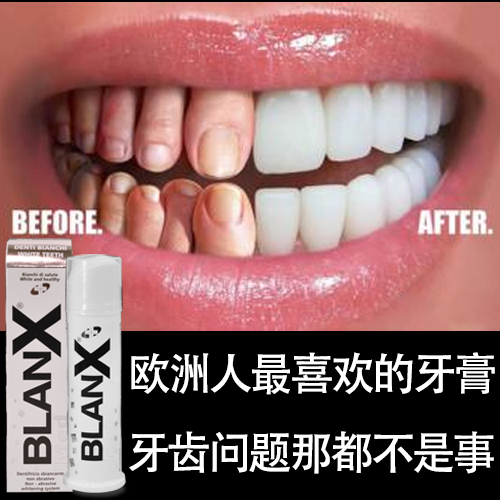 进口blanx正品高端美白牙膏 健康护齿去渍 清新口气成人儿童牙膏